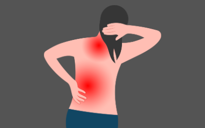 Fibromyalgia Management